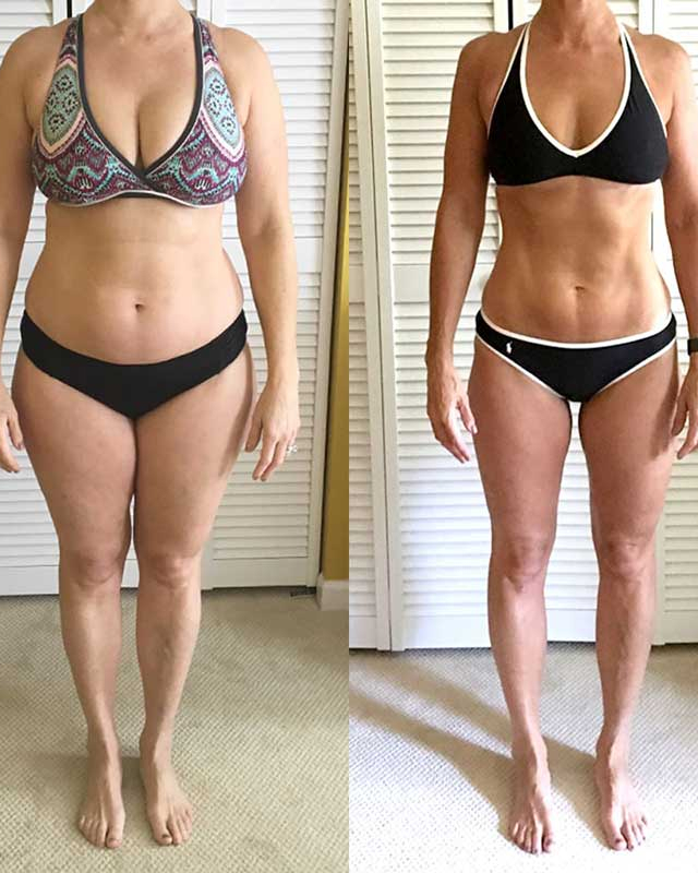 ANTES E DEPOIS