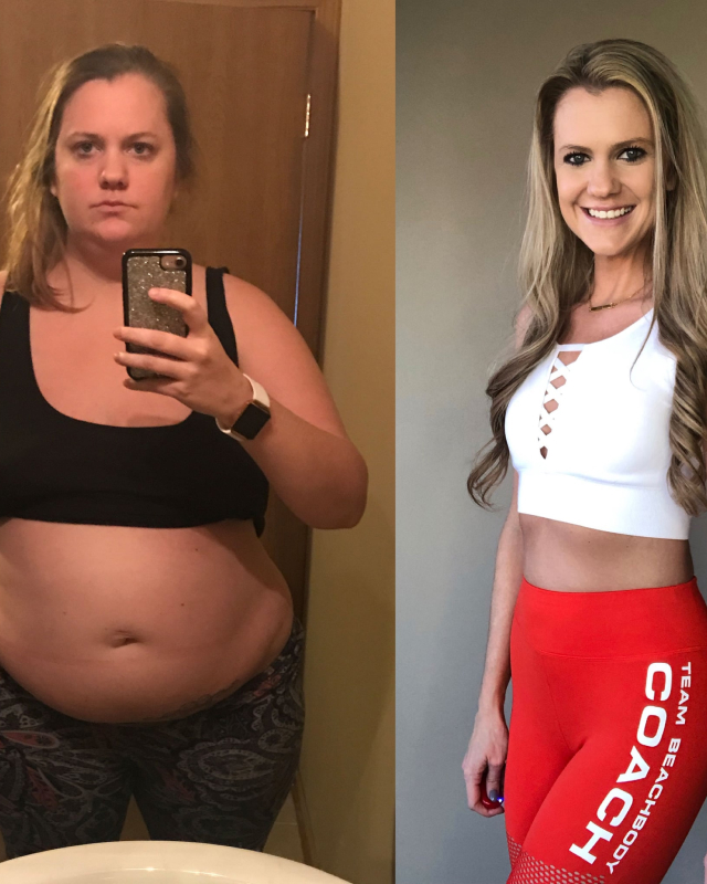 ANTES E DEPOIS